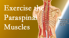 Vancouver Disc Centers describes the importance of paraspinal muscles and their strength for Vancouver back pain relief.