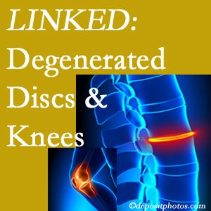 Degenerated discs and degenerated knees are not such unlikely companions. They are seen to be related. Vancouver patients with a loss of disc height due to disc degeneration often also have knee pain related to degeneration.  