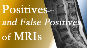 Vancouver Disc Centers carefully chooses when and if MRI images are needed to guide the Vancouver chiropractic treatment plan. 
