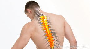 Vancouver thoracic spine pain image 