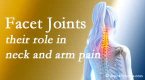 Vancouver Disc Centers carefully examines, diagnoses, and treats cervical spine facet joints for neck pain relief when they are involved.