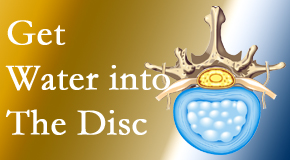 Vancouver Disc Centers uses spinal manipulation and exercise to enhance the diffusion of water into the disc which supports the health of the disc.