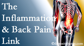 Vancouver Disc Centers addresses the inflammatory process that accompanies back pain as well as the pain itself.