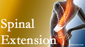 Vancouver Disc Centers understands the role of extension in spinal motion, its necessity, its benefits and potential harmful effects. 