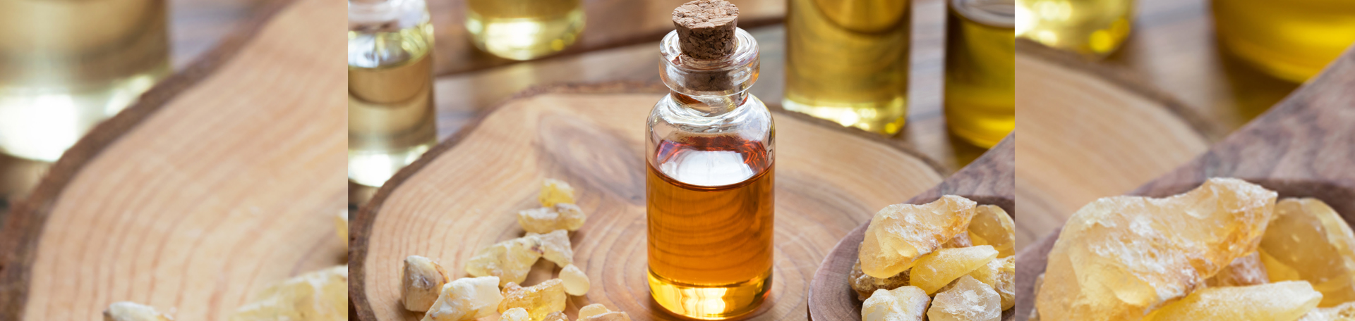 Vancouver anti-inflammatory frankincense