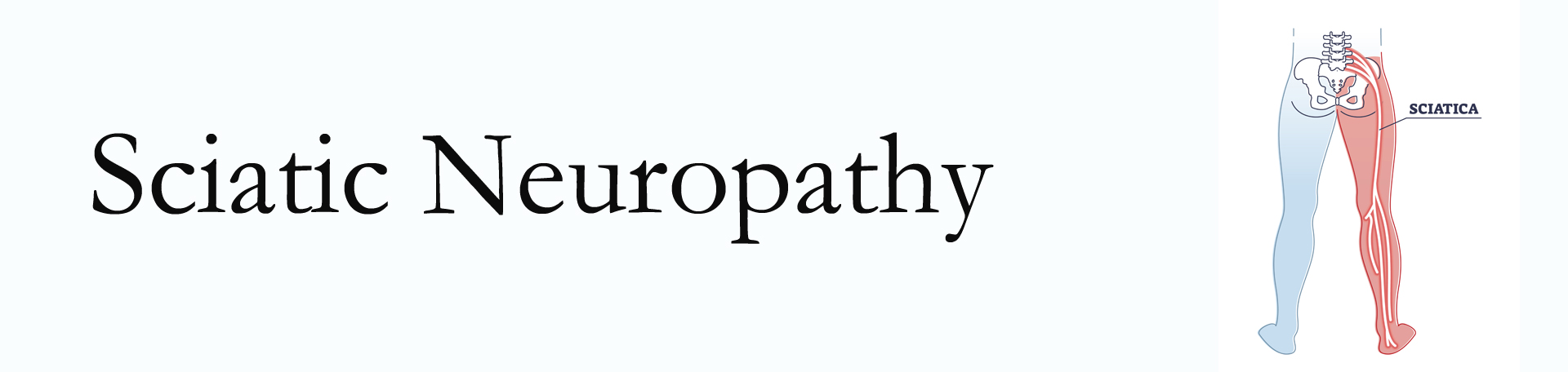 Vancouver neuropathy pain (sciatica) 