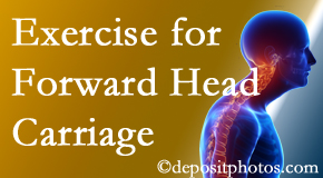Vancouver chiropractic treatment of forward head carriage is two-fold: manipulation and exercise.