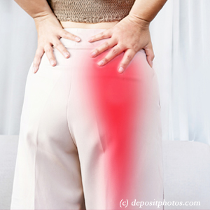 picture of Vancouver leg pain, sciatica, lumbar radiculopathy