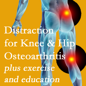 A chiropractic treatment plan for Vancouver knee pain and hip pain due to osteoarthritis: education, exercise, distraction.
