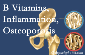 Vancouver chiropractic care of osteoporosis often comes with nutritional tips like b vitamins for inflammation reduction and for prevention.