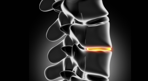 Vancouver chiropractic nutrition with vitamin D and quercitrin