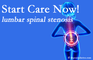 Vancouver Disc Centers presents research that emphasizes that non-operative treatment for spinal stenosis within a month of diagnosis is beneficial. 