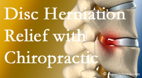Vancouver Disc Centers gently treats the disc herniation causing back pain. 